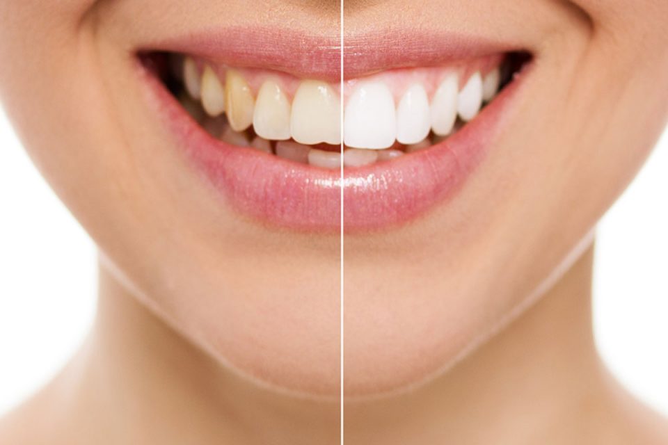 Cosmetic Dentistry