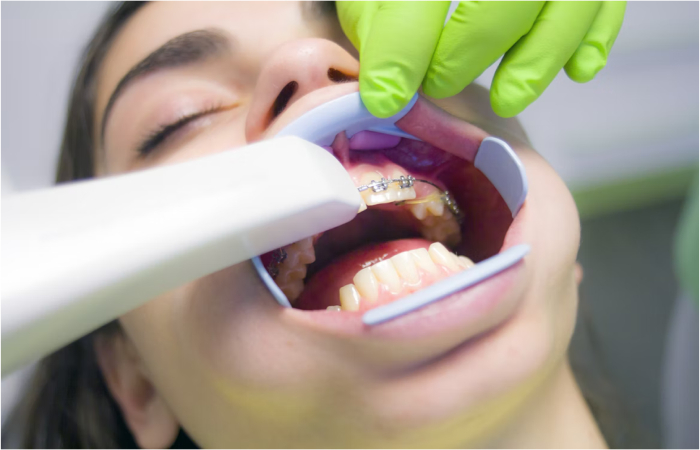 How To Choose an Orthodontist in UAE and Dubai